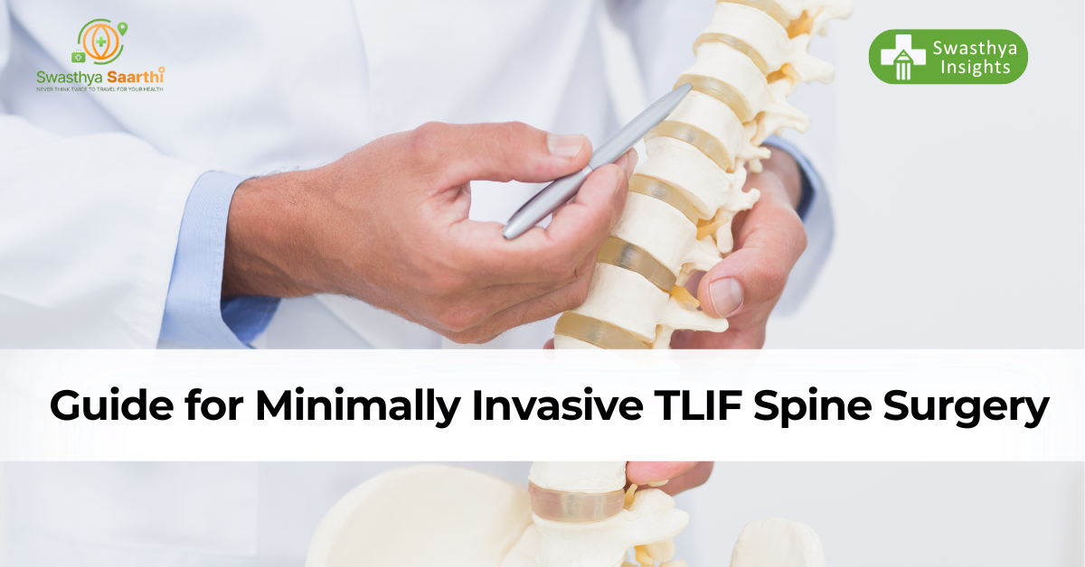 Preparing for MIS TLIF Spine Surgery: A Comprehensive Guide