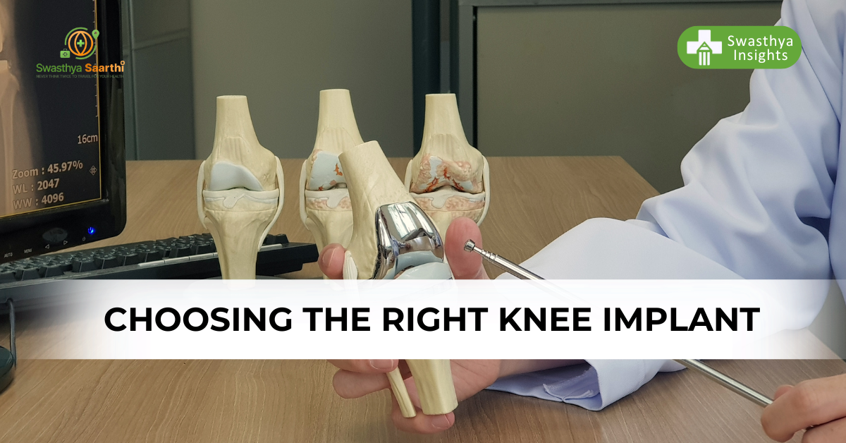 Guide to choose Knee Implant: Top knee implant brands in India